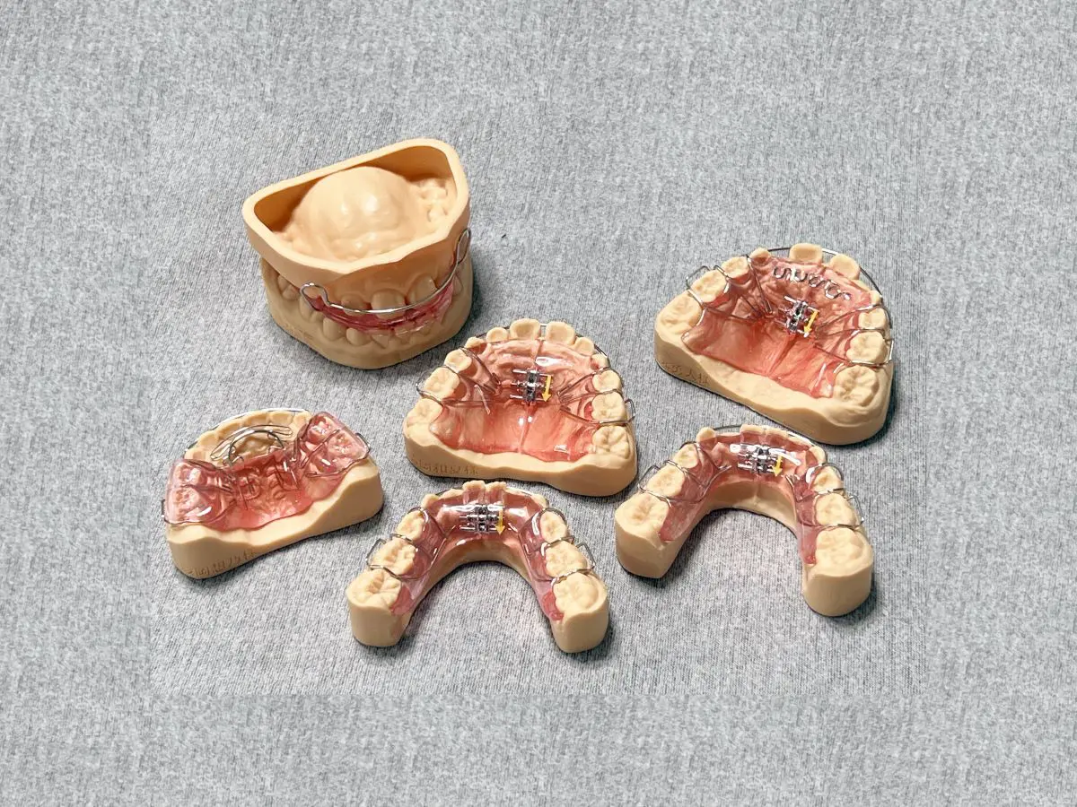 矯正ラボ｜矯正専門歯科技工所 ラボ森嶋 |